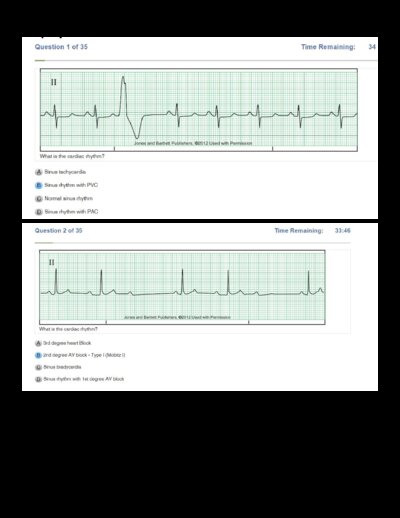 Relias Dysrhythmia Basic Test Prep Answers 2025