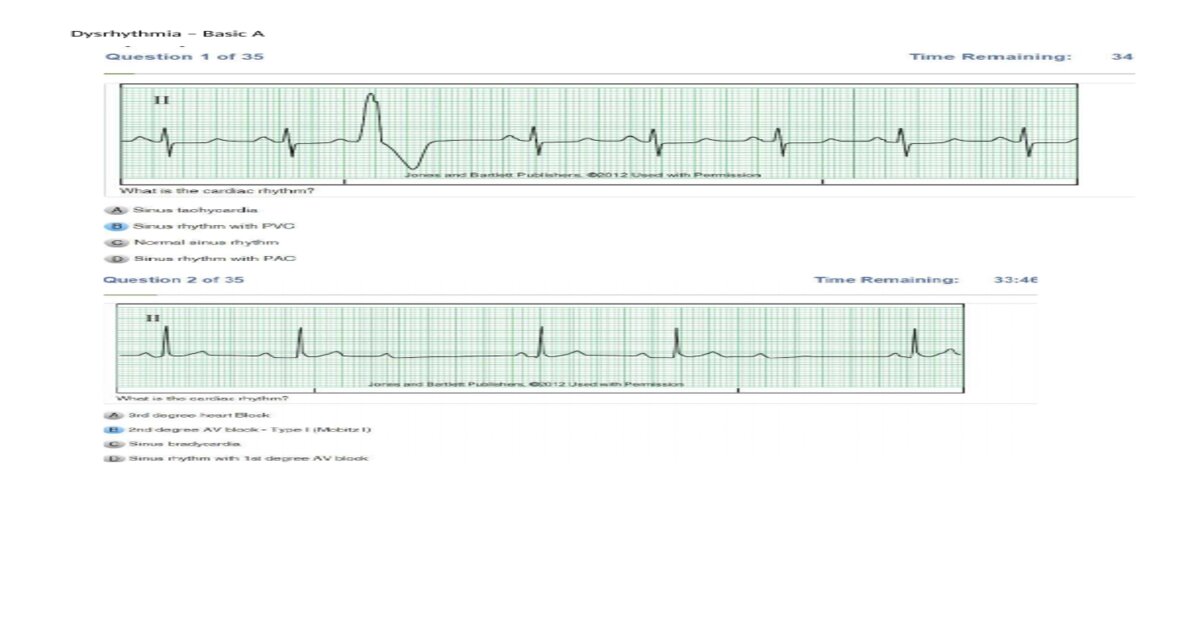 RELIAS DYSRHYTHMIA BASIC A TEST WITH ANSWERS 2025/2026